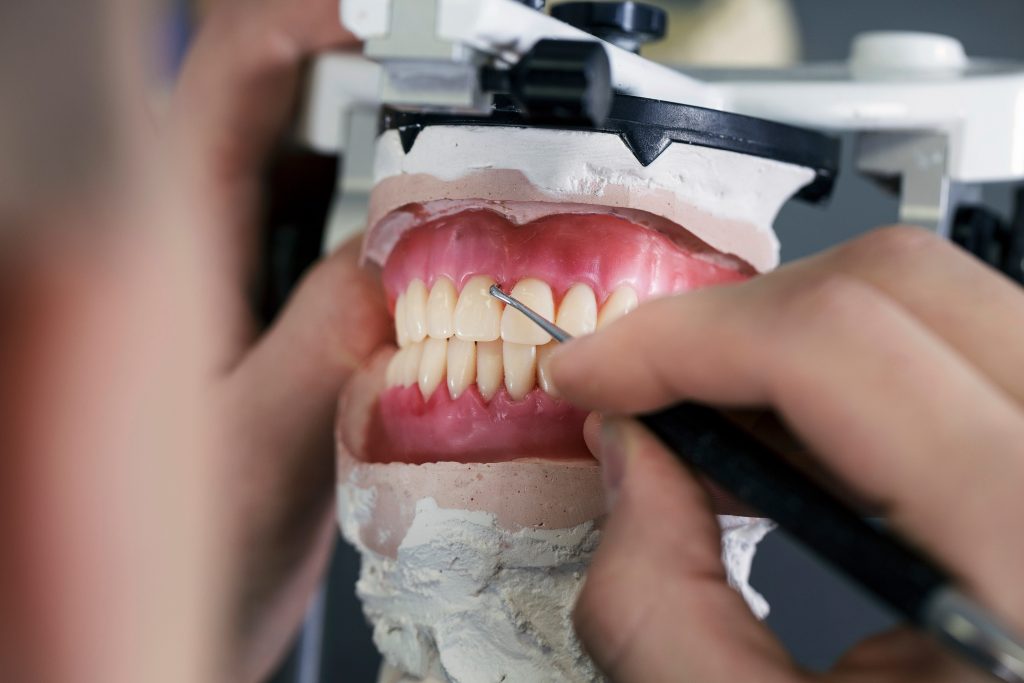 Tandtekniker som jobbar med avtagbar protes käke